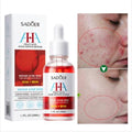 Sadoer Fruit Acid AHA Plus BHA Acne Repair Serum- 30ml