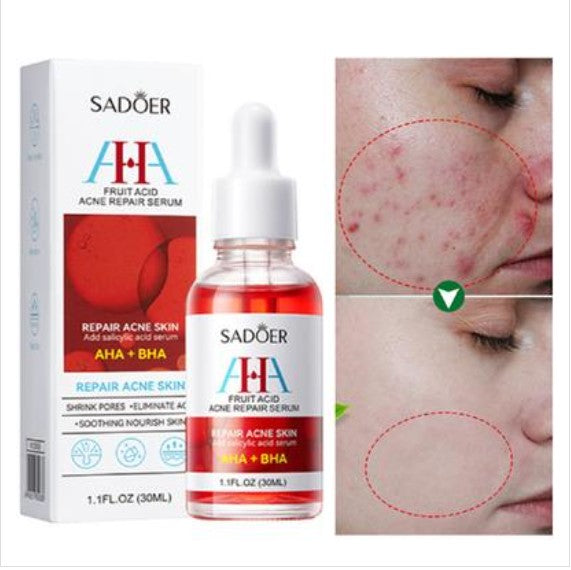 Sadoer Fruit Acid AHA Plus BHA Acne Repair Serum- 30ml