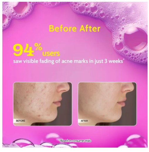Chemist at Play 2% Salicylic Acid Face Wash | Acne & Oil Control For Oily Skin