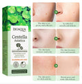 BIOAQUA Centella Asiatica Soothing Repair Facial Serum Nourish Oil Control Anti-Acne Face Skin Care 30ml