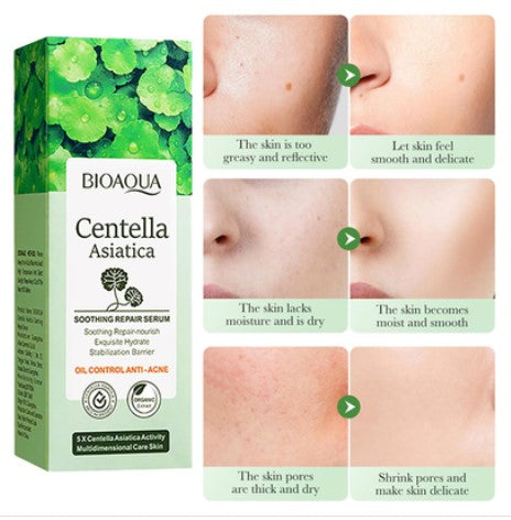 BIOAQUA Centella Asiatica Soothing Repair Facial Serum Nourish Oil Control Anti-Acne Face Skin Care 30ml